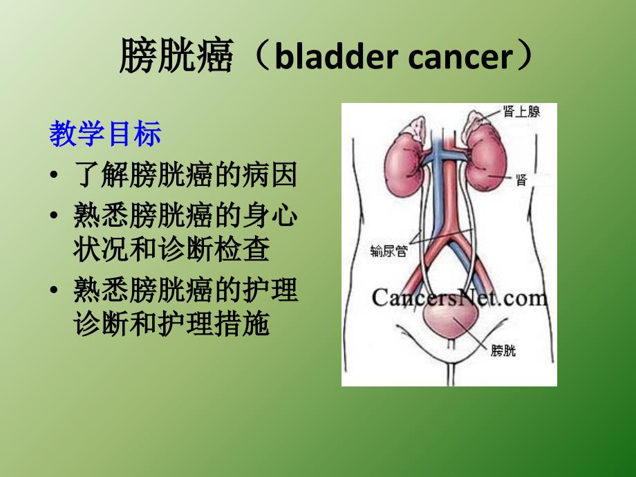 外科护理泌尿系肿瘤本科ppt医学课件_第2页