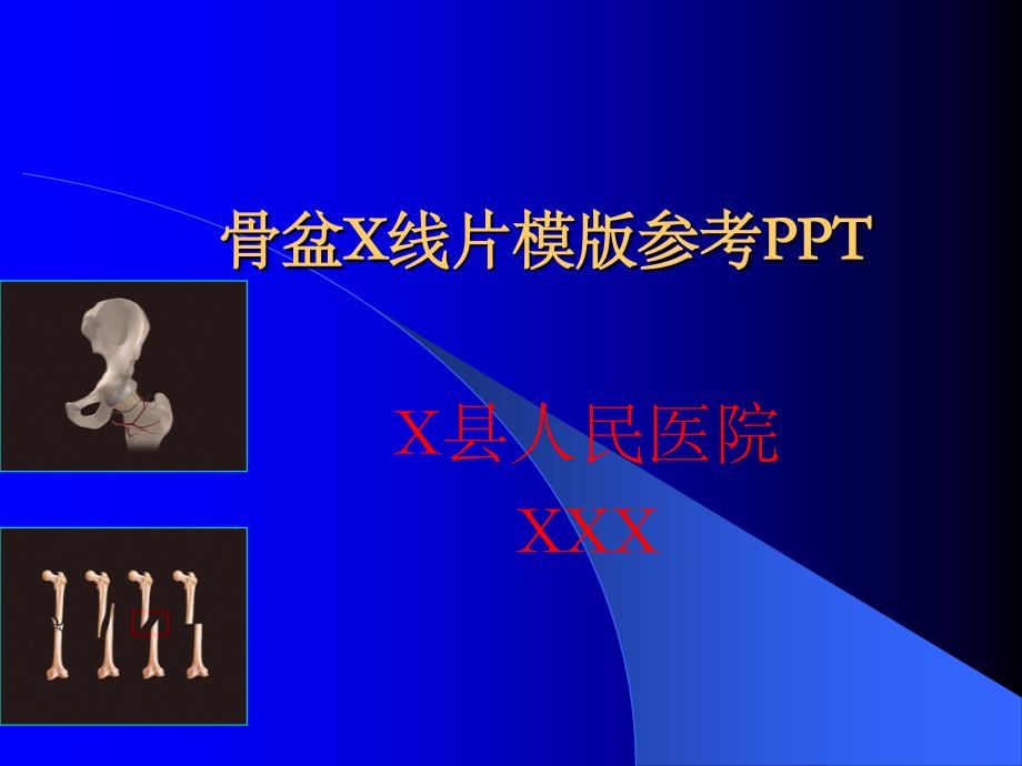骨盆X线片模版参考PPT_第1页