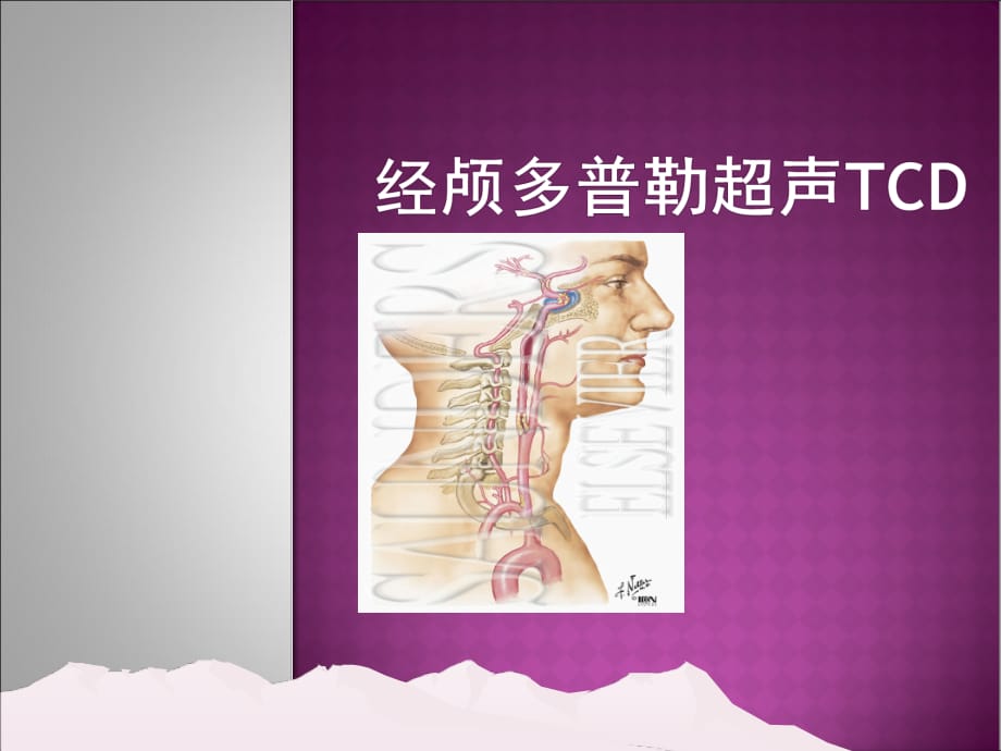 经颅多普勒 T C D解ppt医学课件_第1页