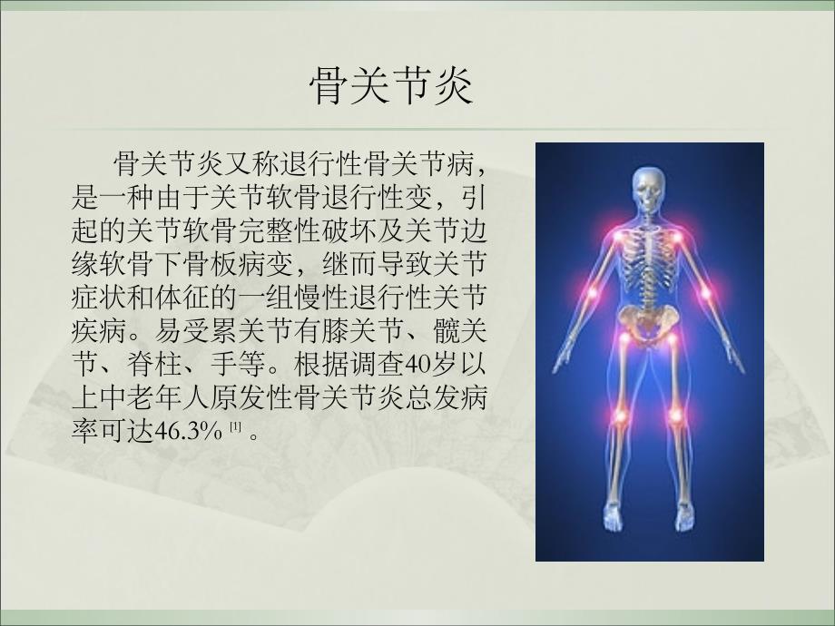 骨关节炎的手术时机选择参考PPT_第4页