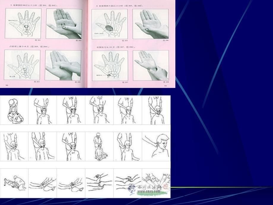 段氏脏腑按摩疗法课件PPT_第5页