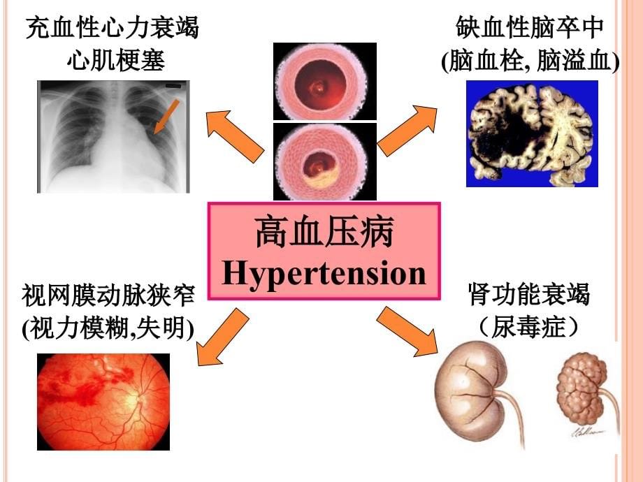 降压药本课件PPT_第5页