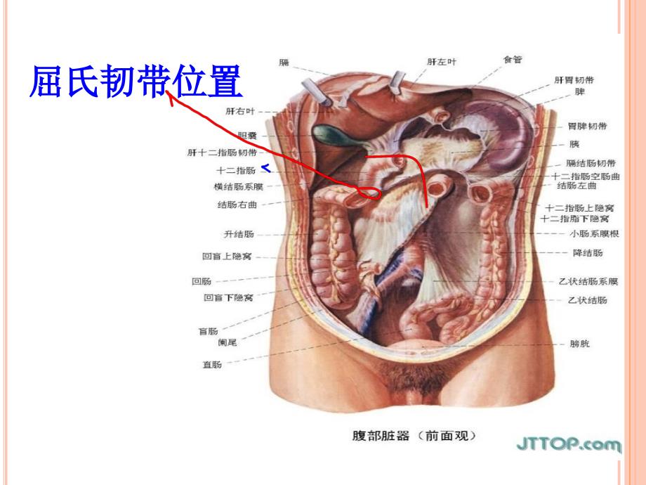 消化道出血的急救处理课件PPT_第3页