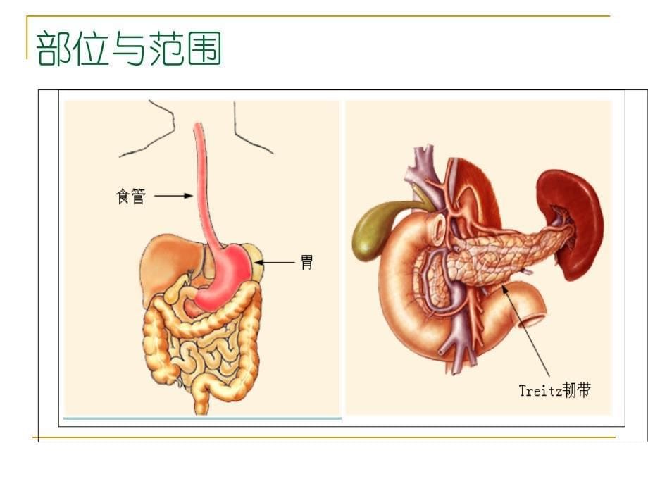 上消化道出血病人的治疗与护理课件PPT_第5页