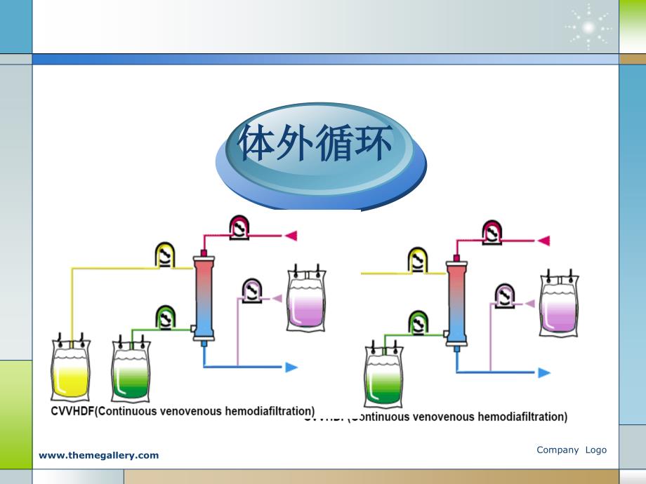 CRRT体外循环管理_第2页