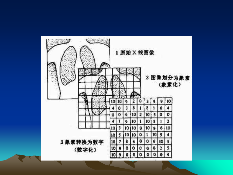 数字减影血管造影(DSA)教程文件_第4页