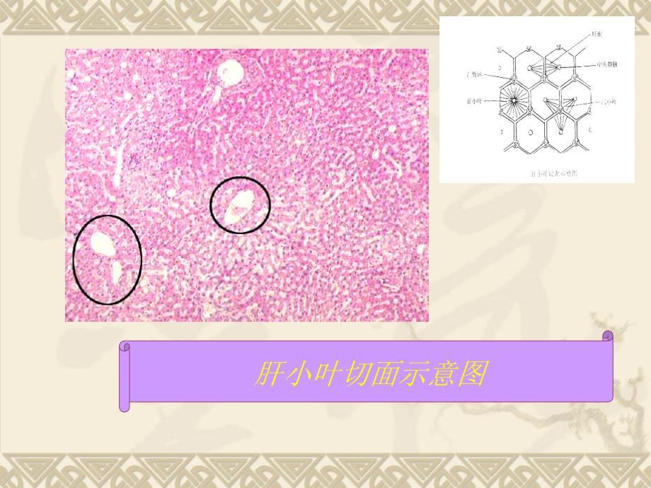 门脉高压症课件PPT_第4页