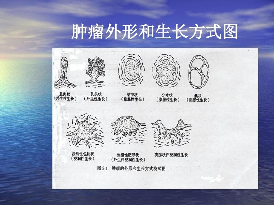 病理与生理学渭病理与生理学asanclass课件PPT_第5页