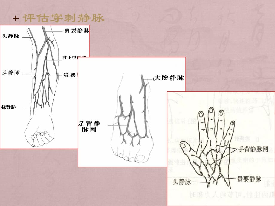 密闭式静脉输液法课件PPT_第3页