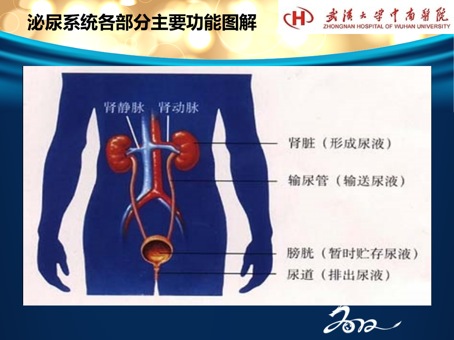 泌尿系结石病人护理课件PPT_第4页