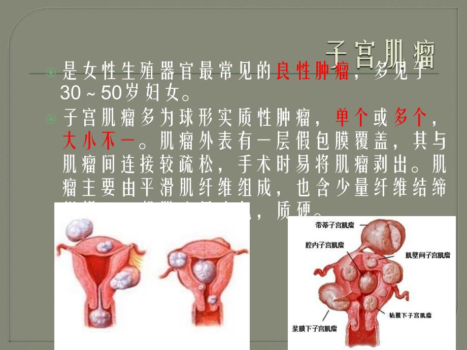 妇科常见疾病的临床特点课件PPT_第2页