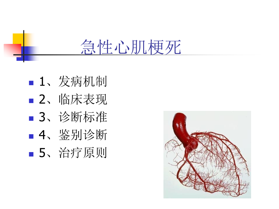 急性心肌梗死的识别课件PPT_第2页