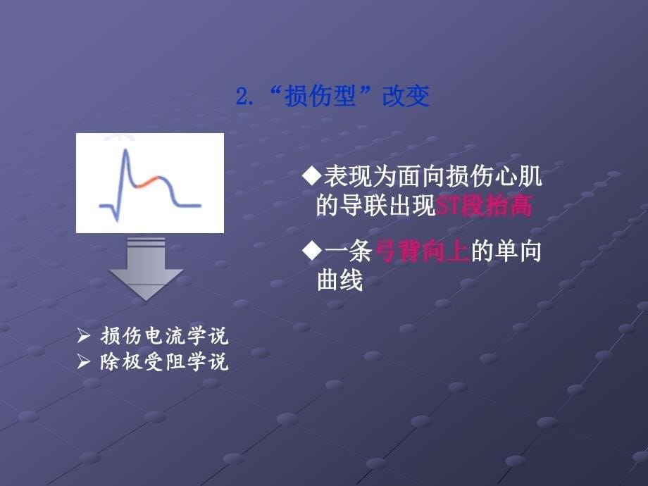 心肌梗死课件PPT_第5页