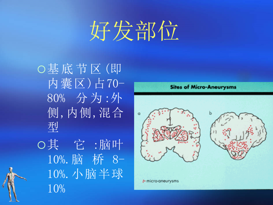 脑出血CerebralHaemorrahge课件PPT_第3页