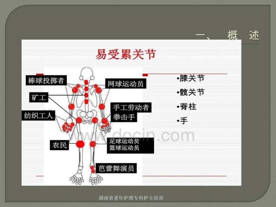 老退行性骨关病患者的护理课件PPT_第5页