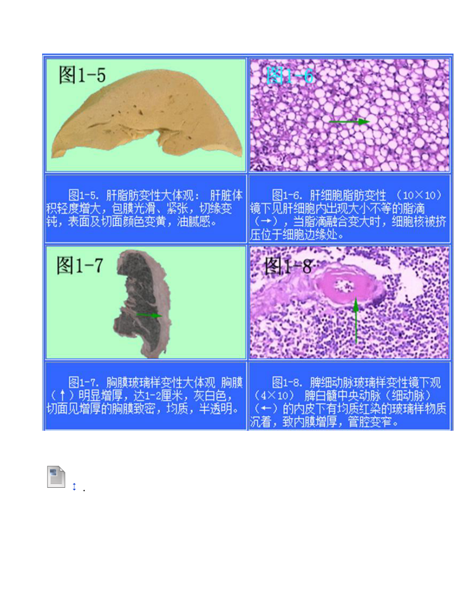 病理病例大体及玻片标本(复习神器带你超神)海医.doc_第3页