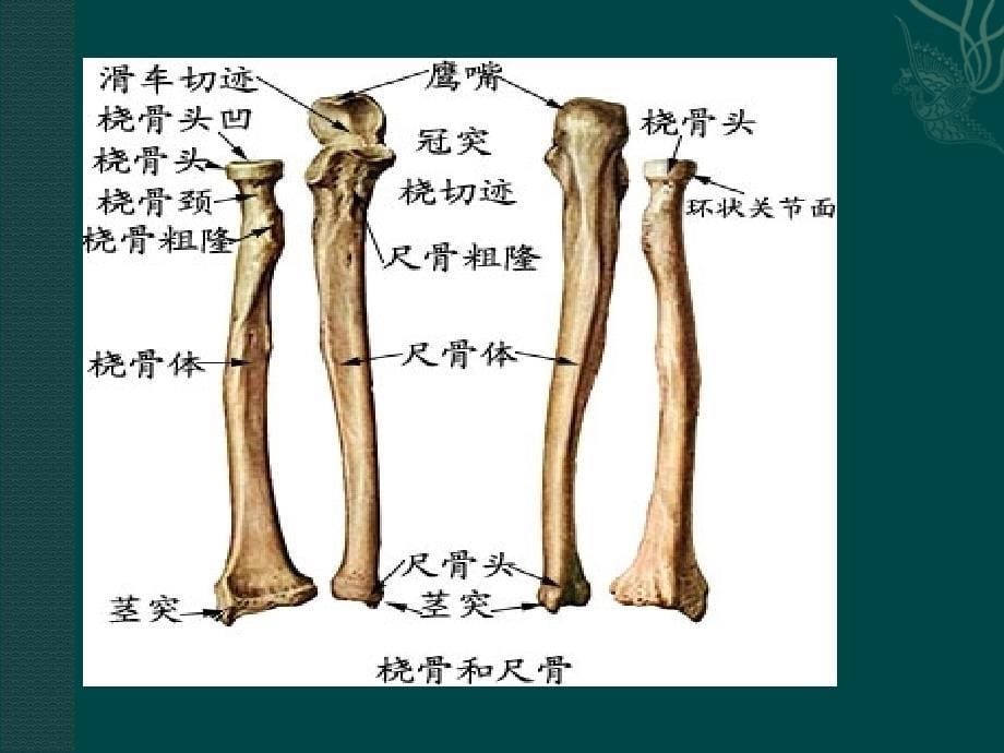 尺桡骨骨折的护理课件PPT_第5页