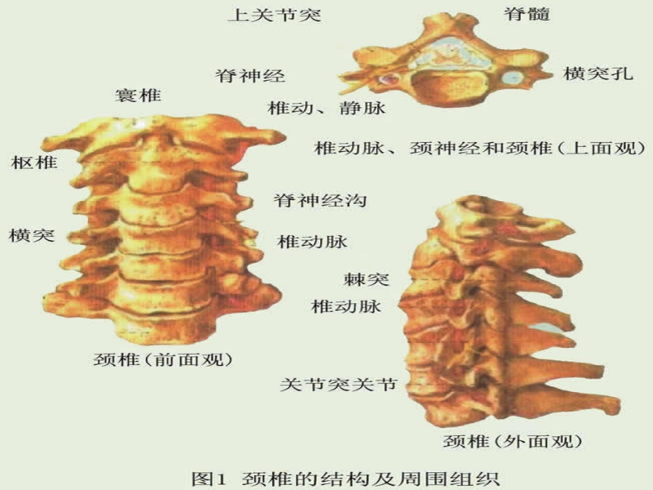 颈椎病知识课件PPT_第4页