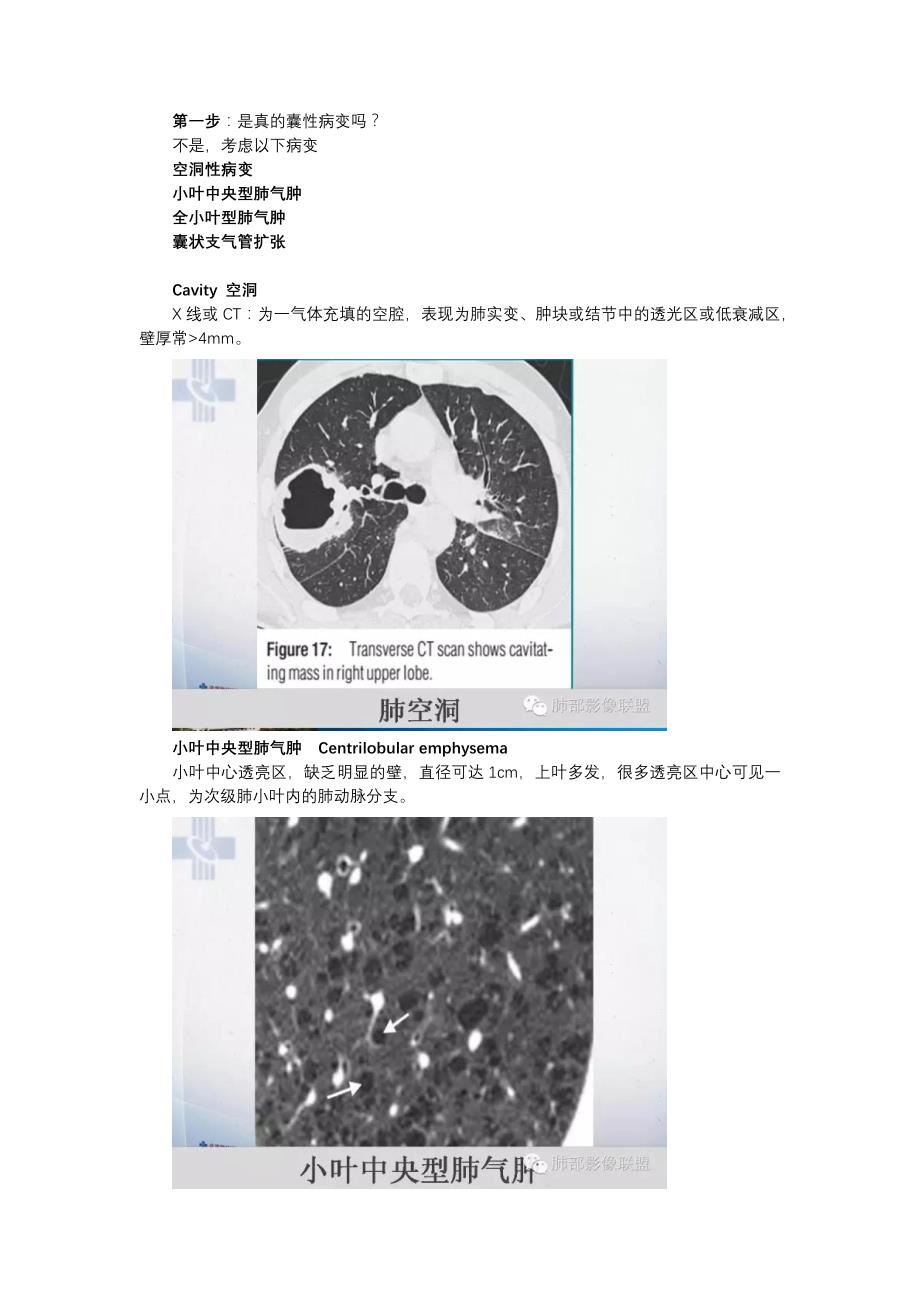 肺部囊性病变诊断和鉴别诊断_第3页