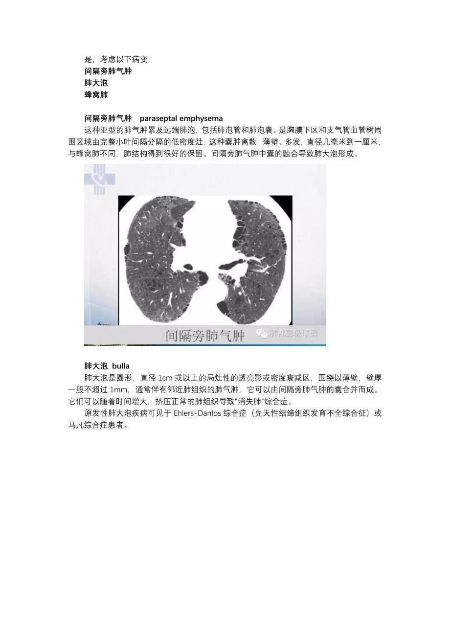 肺部囊性病变诊断和鉴别诊断_第5页