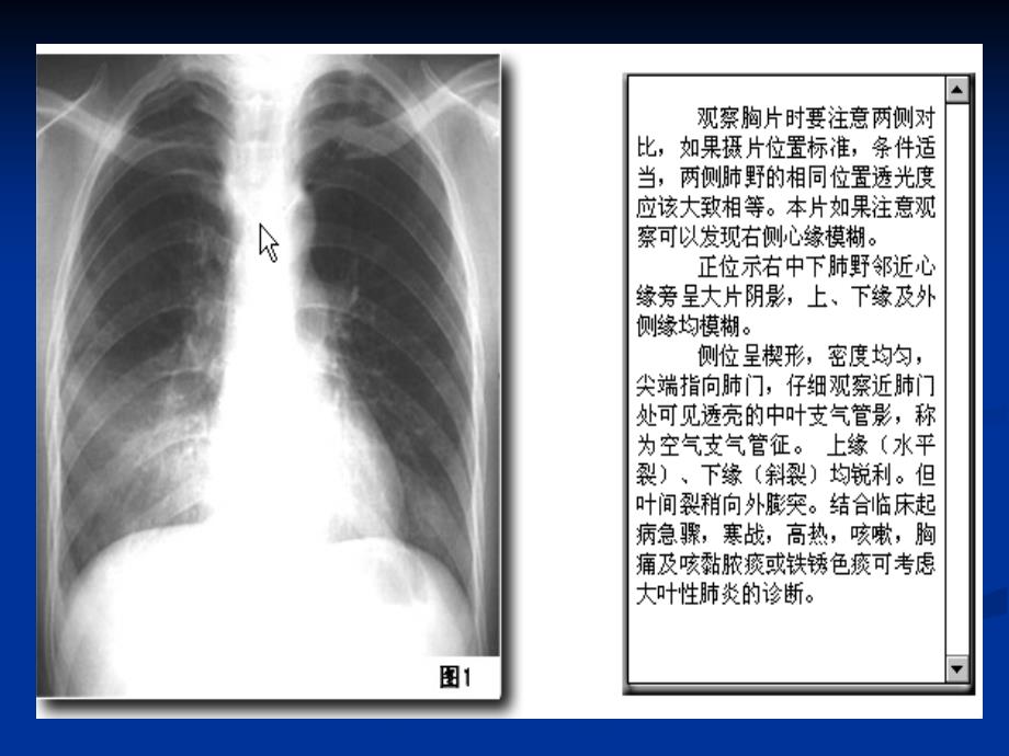 X片读片指南课件PPT_第3页