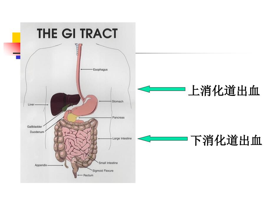 《内科护理学》第十二节上消化道大出血_第2页