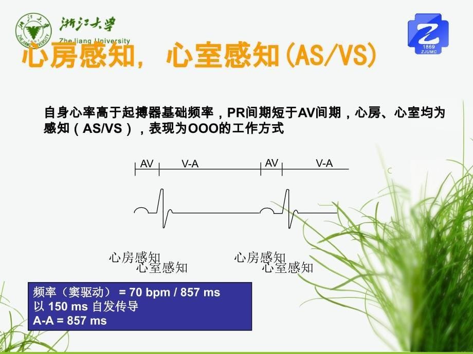 起搏器程控(转)_第5页