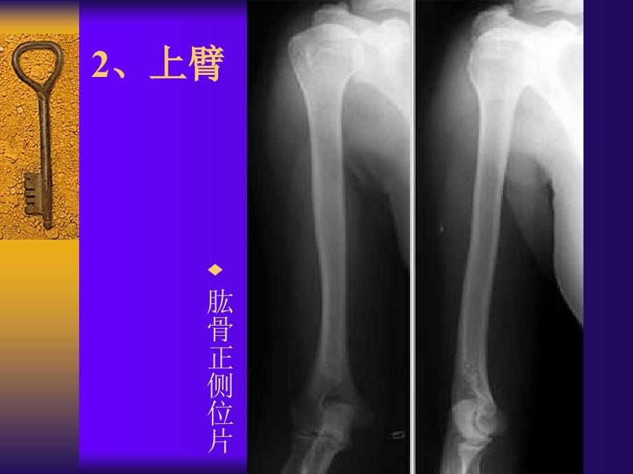 骨关正常X线解剖课件PPT_第5页