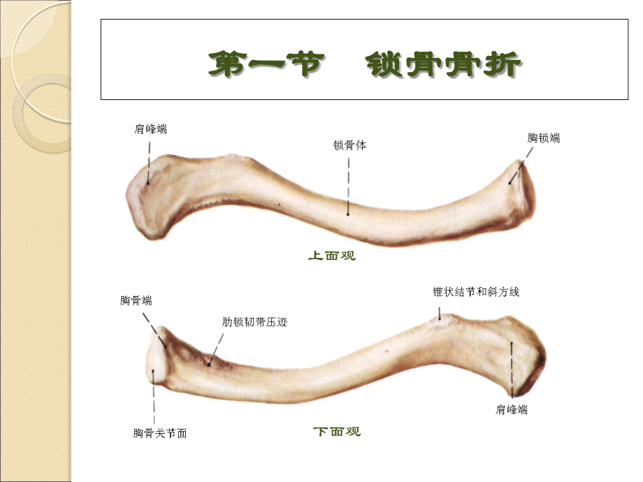 上肢骨、关损伤课件PPT_第2页