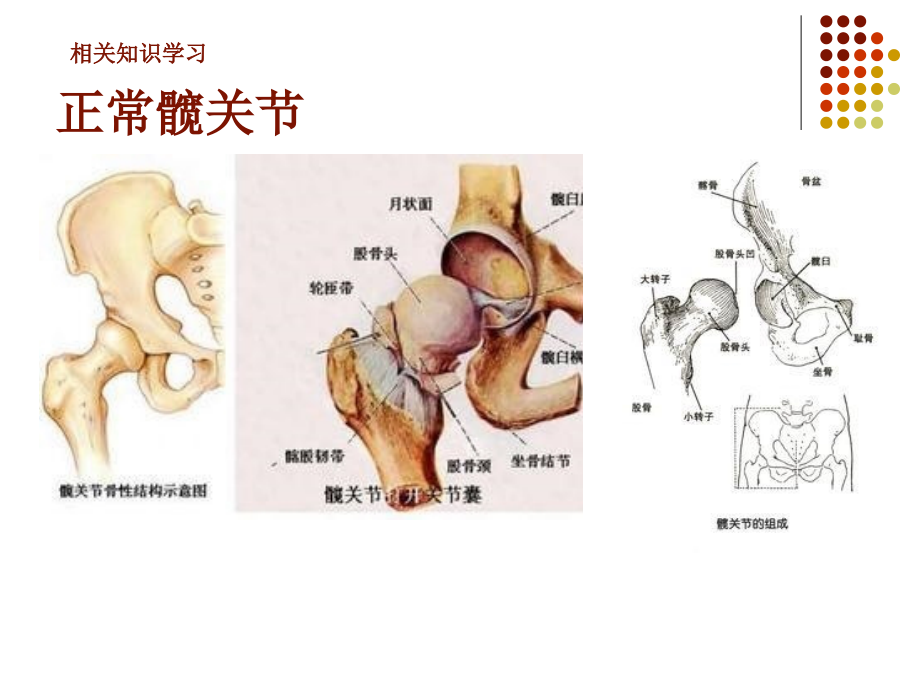 股骨干骨折骨科病区课件PPT_第3页