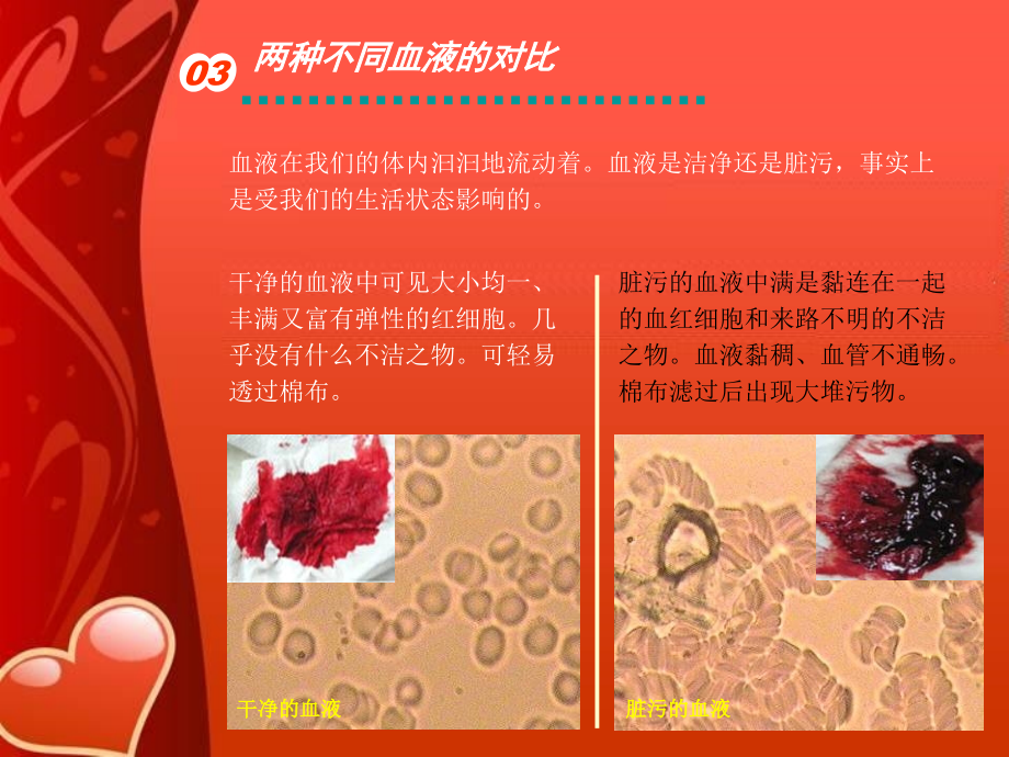 让血液和血管变得更加干净课件PPT_第4页