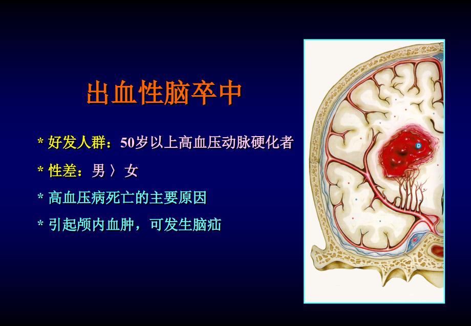 脑卒中的外科治疗课件PPT_第2页