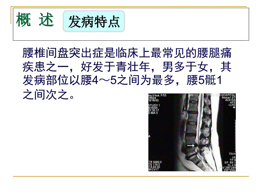 腰椎间盘突出症的针灸治疗演示教学_第4页