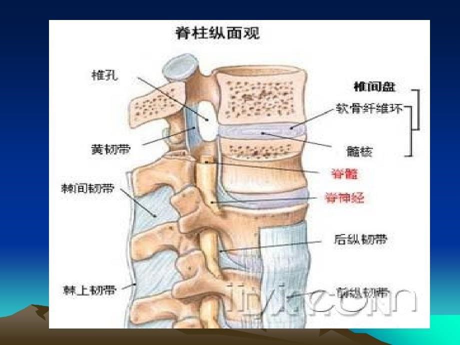 腰椎间盘突出症检查方法培训课件_第5页