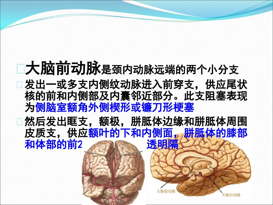颅脑常见血管疾病CT诊断课件PPT_第4页