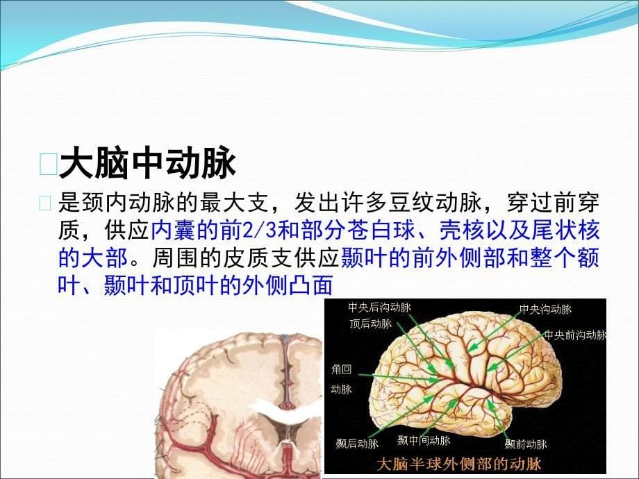 颅脑常见血管疾病CT诊断课件PPT_第5页