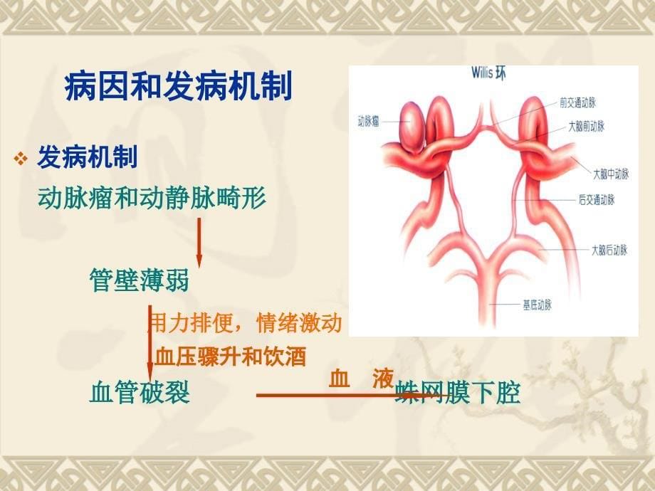 蛛网膜下腔出血病人的护理课件PPT_第5页