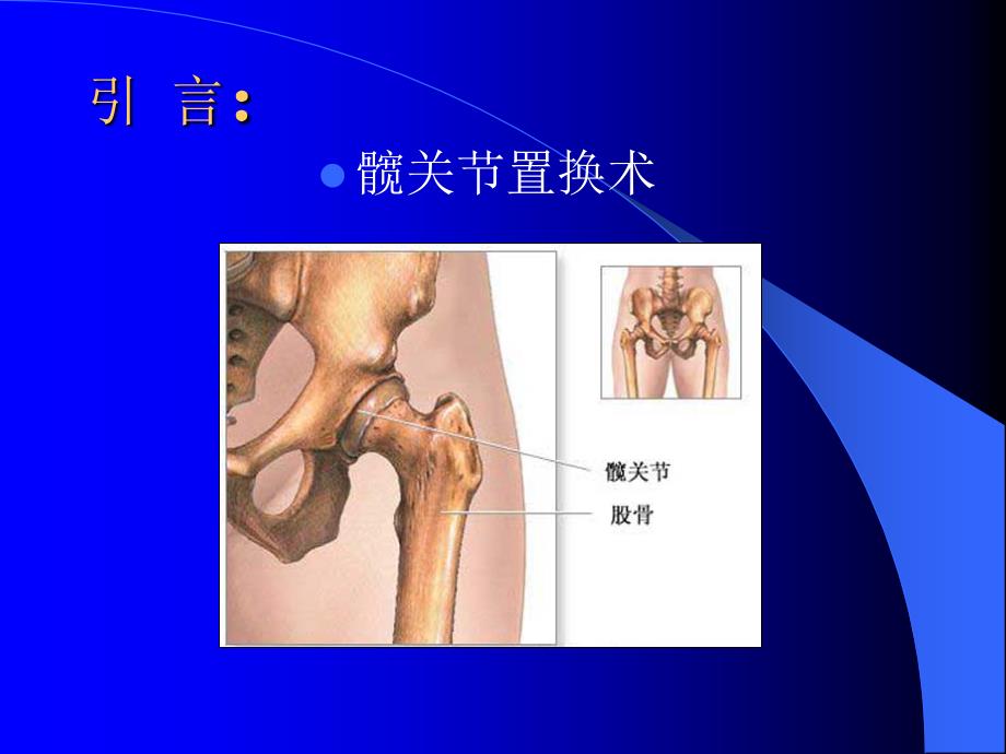 髋关查房课件PPT_第2页