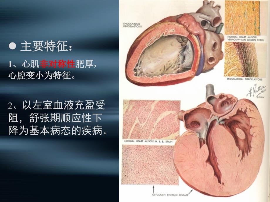 第八章 心肌病(二)_第2页