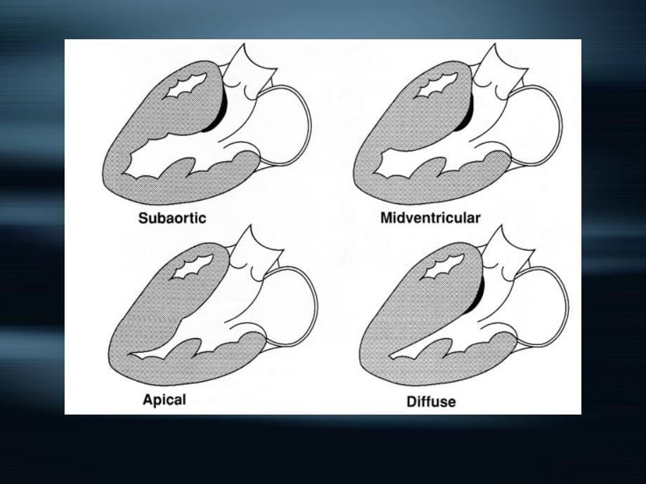 第八章 心肌病(二)_第5页
