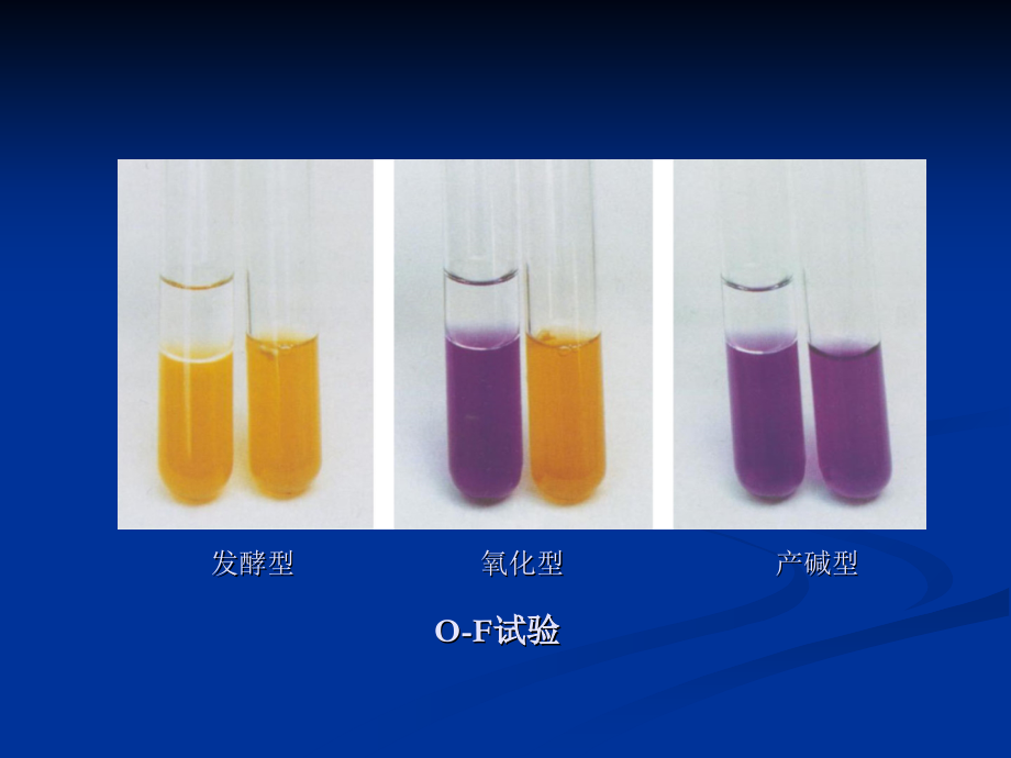 第八章 肠杆菌科细菌_第4页