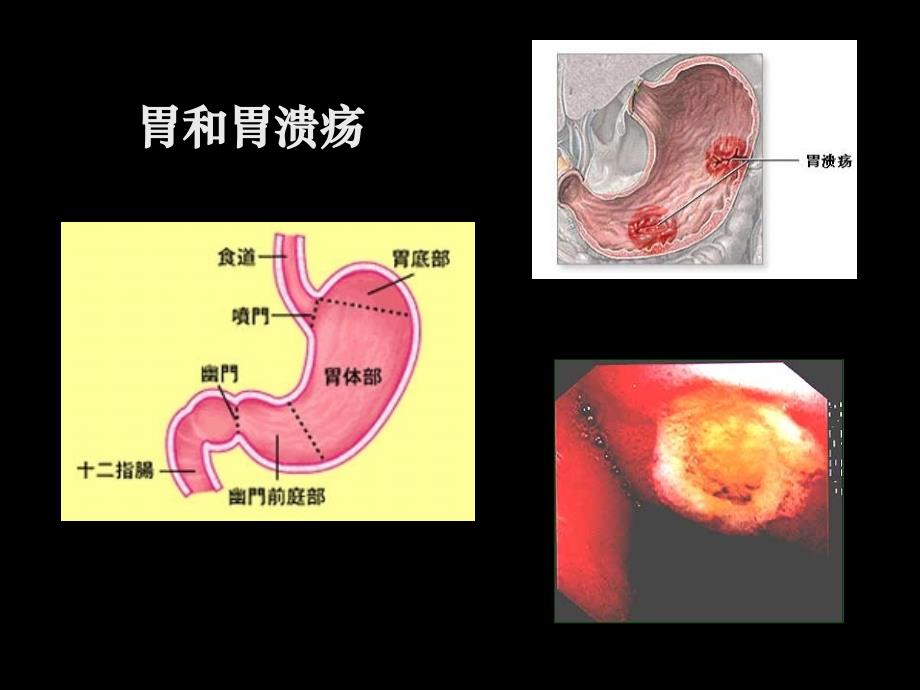 第五章 消化系统药物-2013_第4页