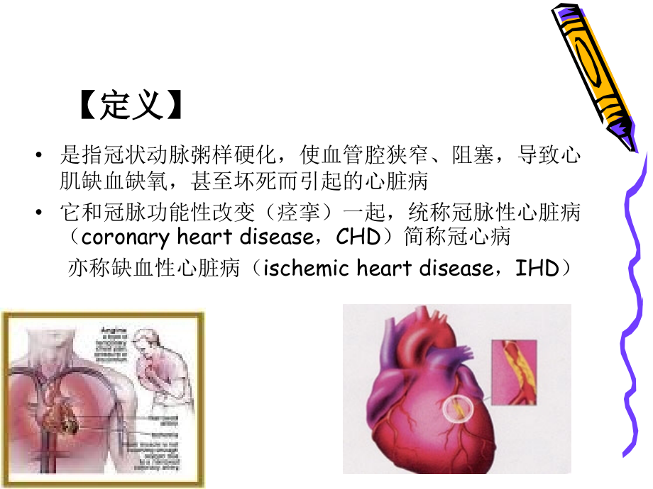 爱爱医资源冠心病课件PPT_第3页