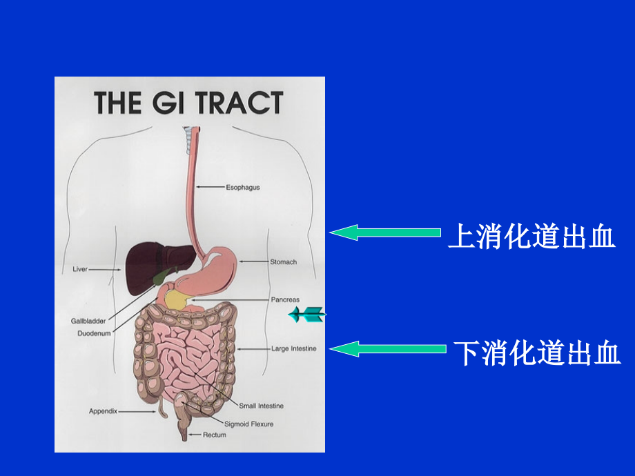 上消化道出血76710_第2页