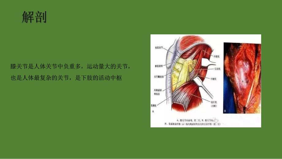 腓骨高位截骨术市立医院骨科课件ppt_第4页