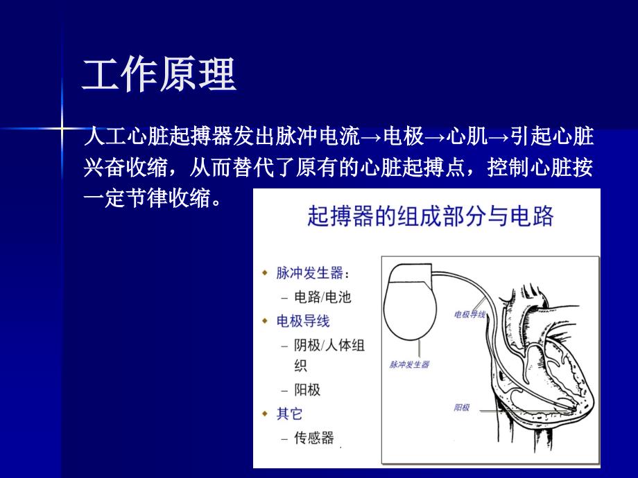 临时起搏器的应用与护理PPT课件_第4页