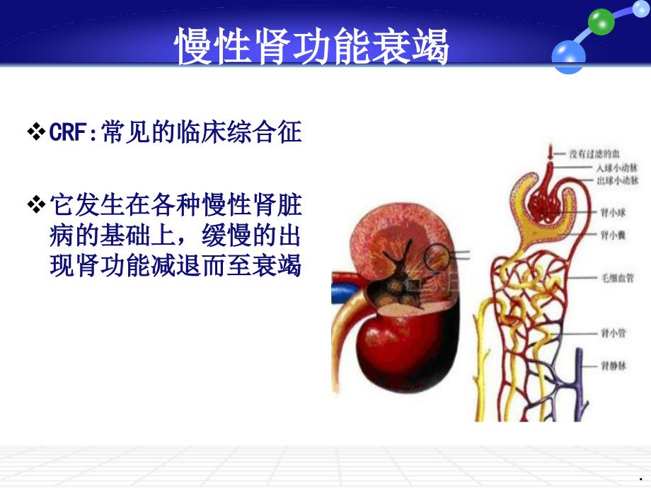 慢性肾功能衰竭护理查房PPT课件_第2页