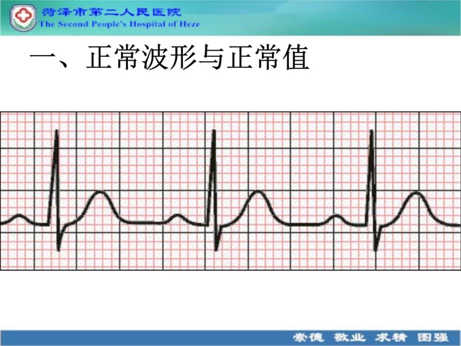 心电图解读说课讲解_第3页