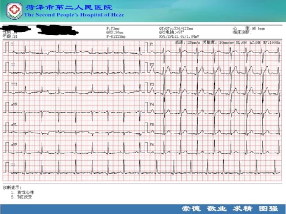 心电图解读说课讲解_第4页