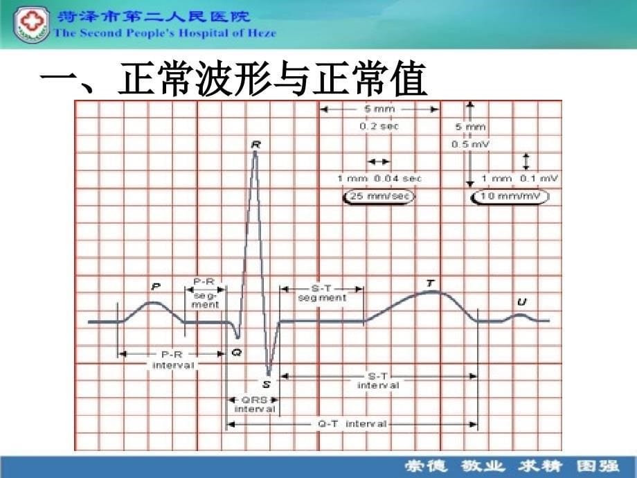 心电图解读说课讲解_第5页